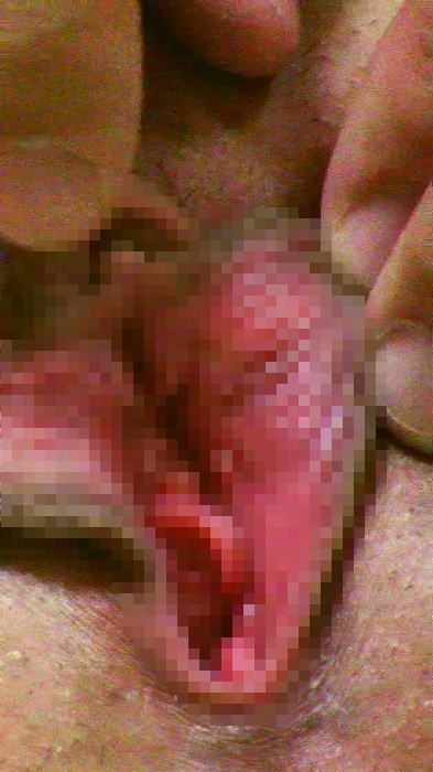 ぱっくりま●こ